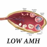 low amh treatment Profile Picture