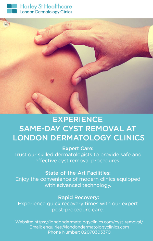 Experience Same-Day Cyst Removal at London Dermatology Clinics - Manufacturers Network | Manufacturers Network