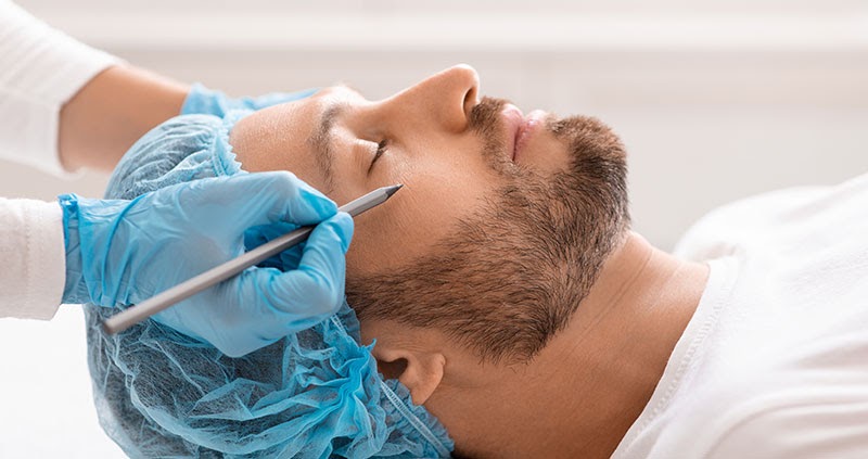 Top 10 Tips for Male Nose Surgery