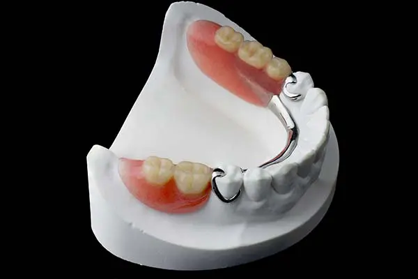 Affordable Partial Denture | Prime Denture Clinic | Edmonton