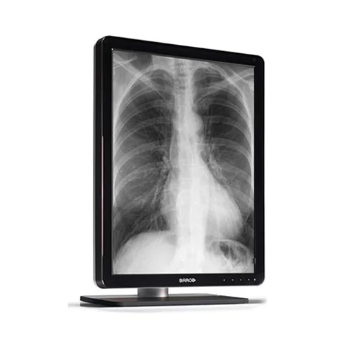 How Do Diagnostic Radiology Monitors Differ from Regular Computer Monitors? - Click To Write