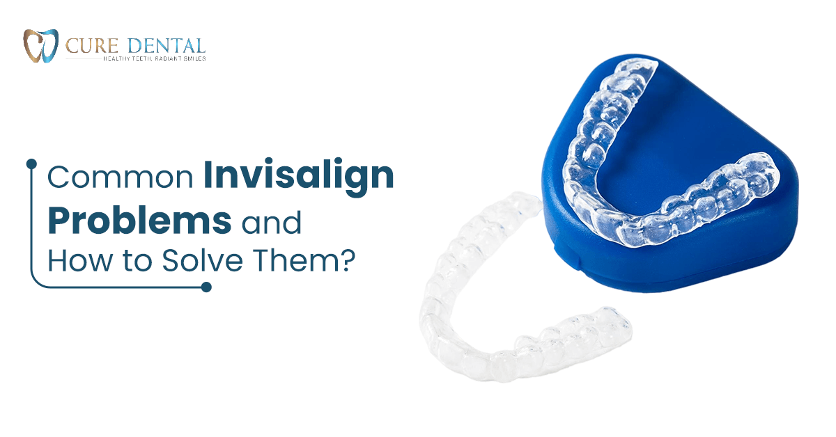 Common Invisalign Problems & How to Solve Them? | Cure Dental