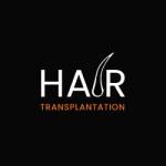 Hair Transplantation Profile Picture