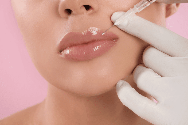 How to Take Advantage of Lip Enlargement Benefits