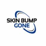 Skin Bump Gone Profile Picture