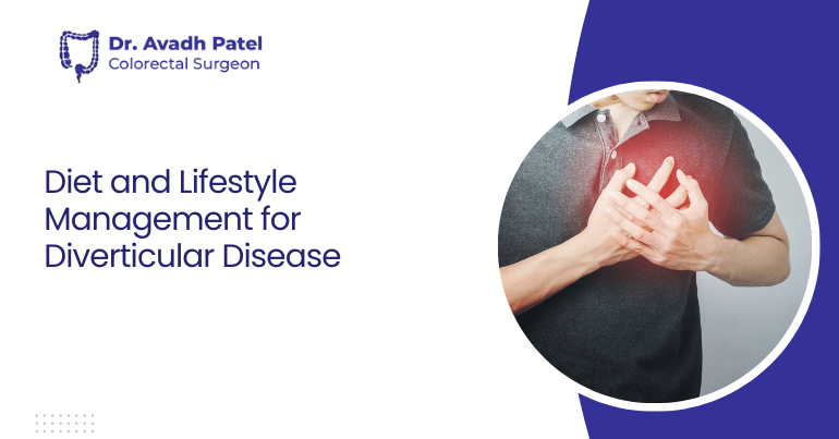 Diet and Lifestyle Management for Diverticular Disease: What You Need to Know