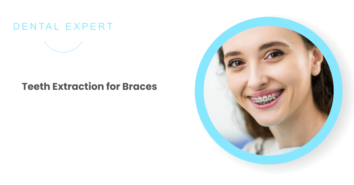 Teeth Extraction for Braces: Alternatives & More | Dental Expert
