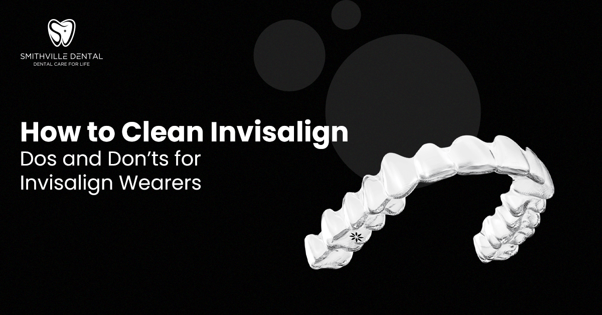 How to Clean Invisalign: Important Tips, Dos and Don'ts