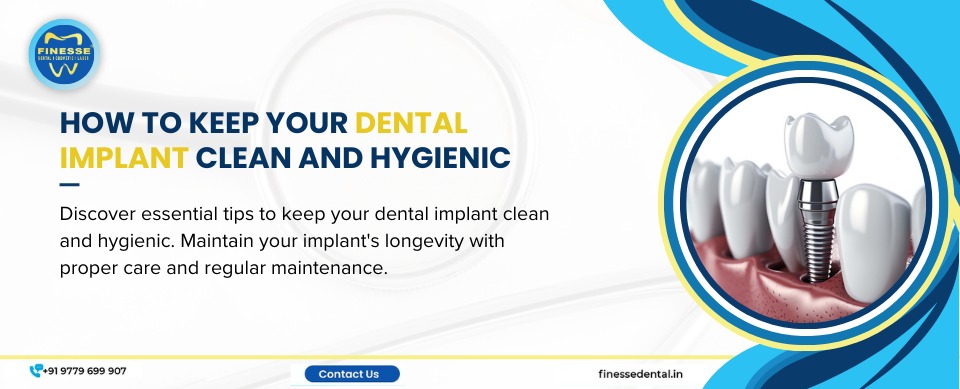 How to Keep Your Dental Implant Clean And Hygienic