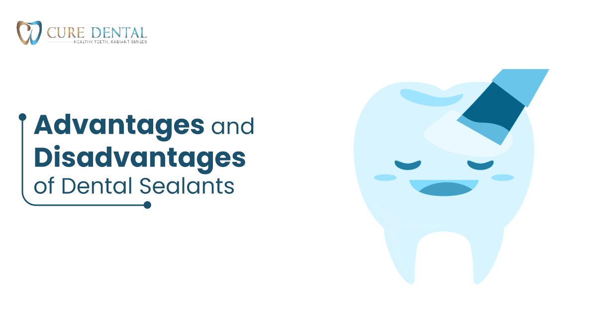 Advantages and Disadvantages of Dental Sealants | Cure Dental
