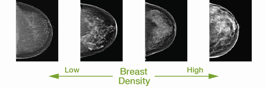 Breast Cancer Screening Program in Ventura, CA
