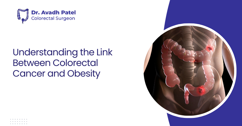 Understanding the Link Between Colorectal Cancer and Obesity