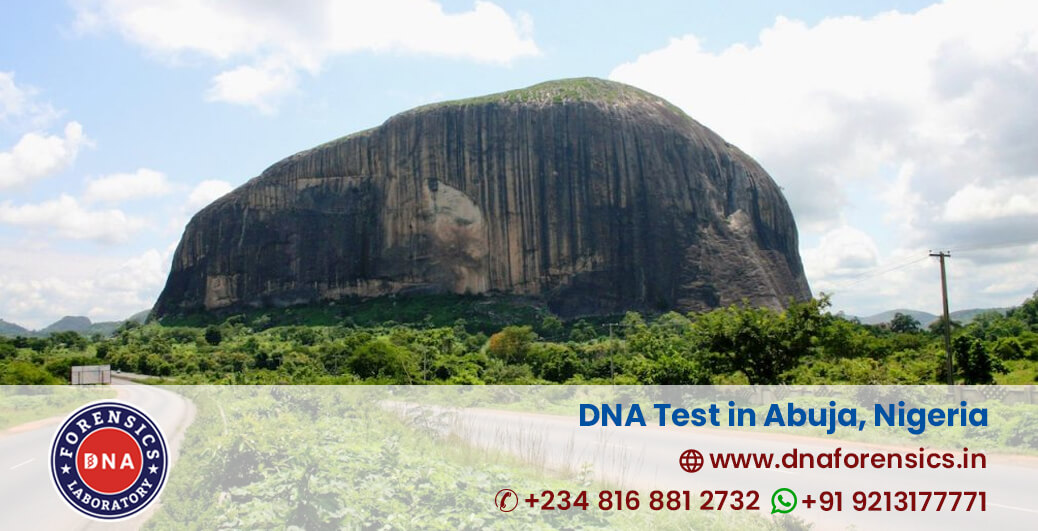 DNA Test Cost in Abuja, Nigeria