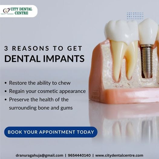 Why Dental Implants Are a Long-Term Solution for Missing Teeth in Noida