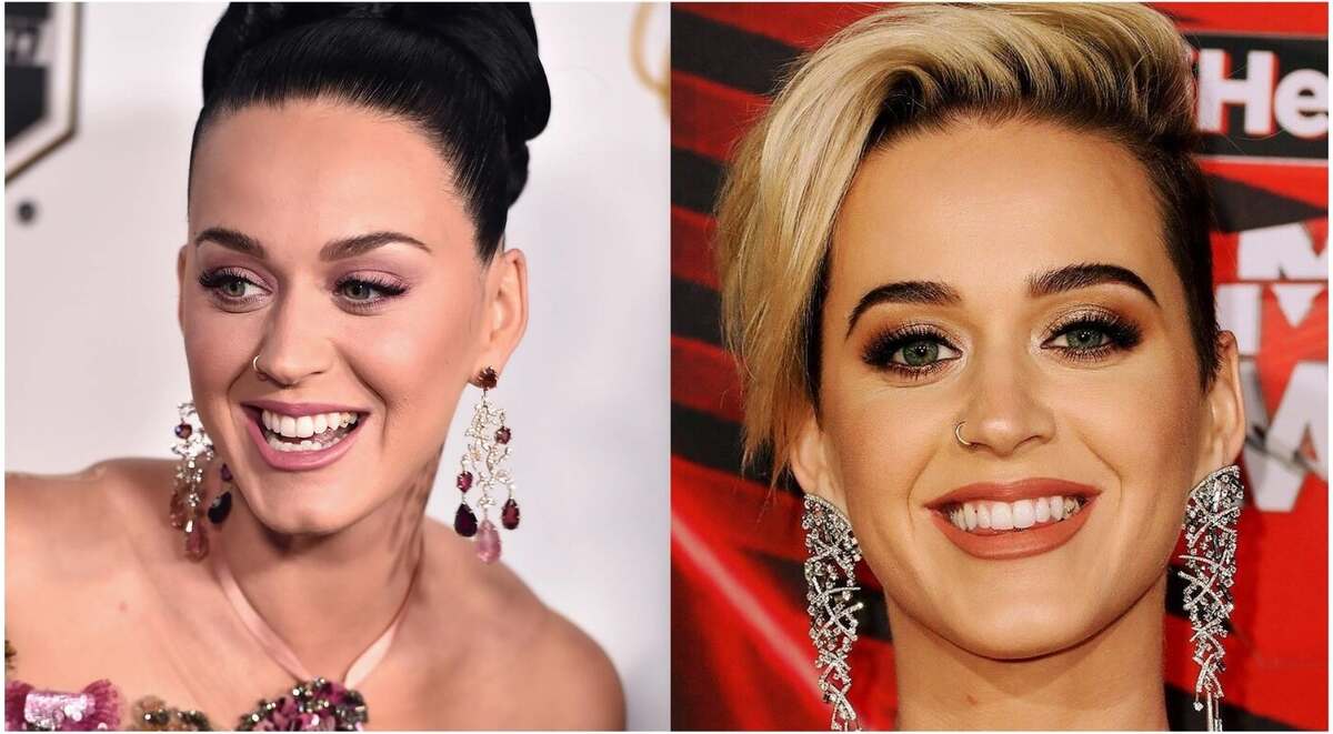 Katy Perry Teeth | The Secret Behind Her Dazzling Smile