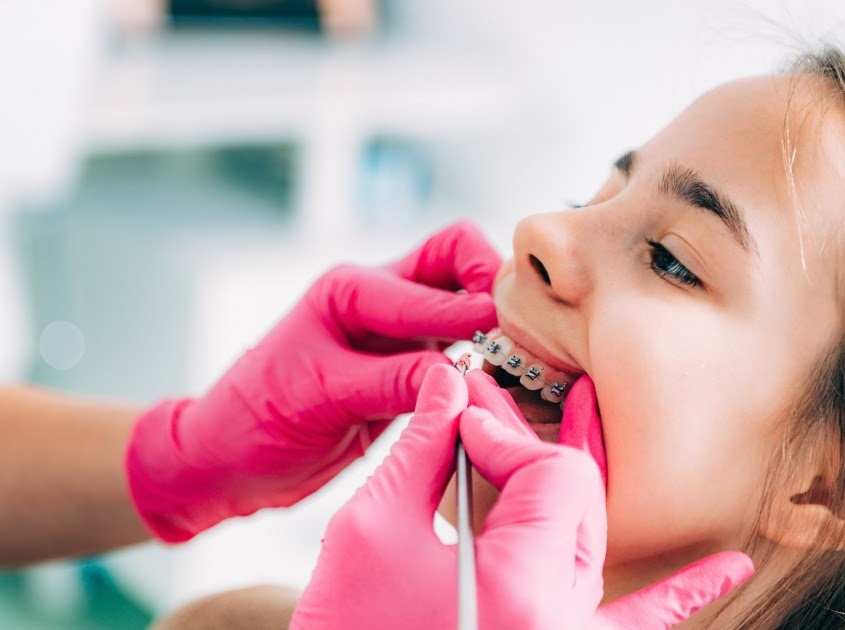 Braces for Kids Is a Head Start for a Healthy Smile
