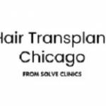 Hair Transplant Chicago profile picture