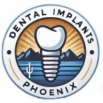 Dental Implants Phoenix Profile Picture