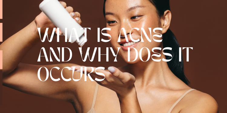 What is Acne and Why Does It Occur? | Deoset