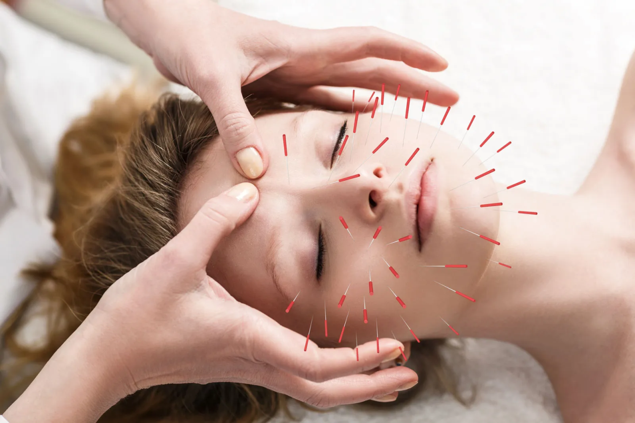 777 Healthcare — Discover the Benefits of Acupuncture in Perth at...