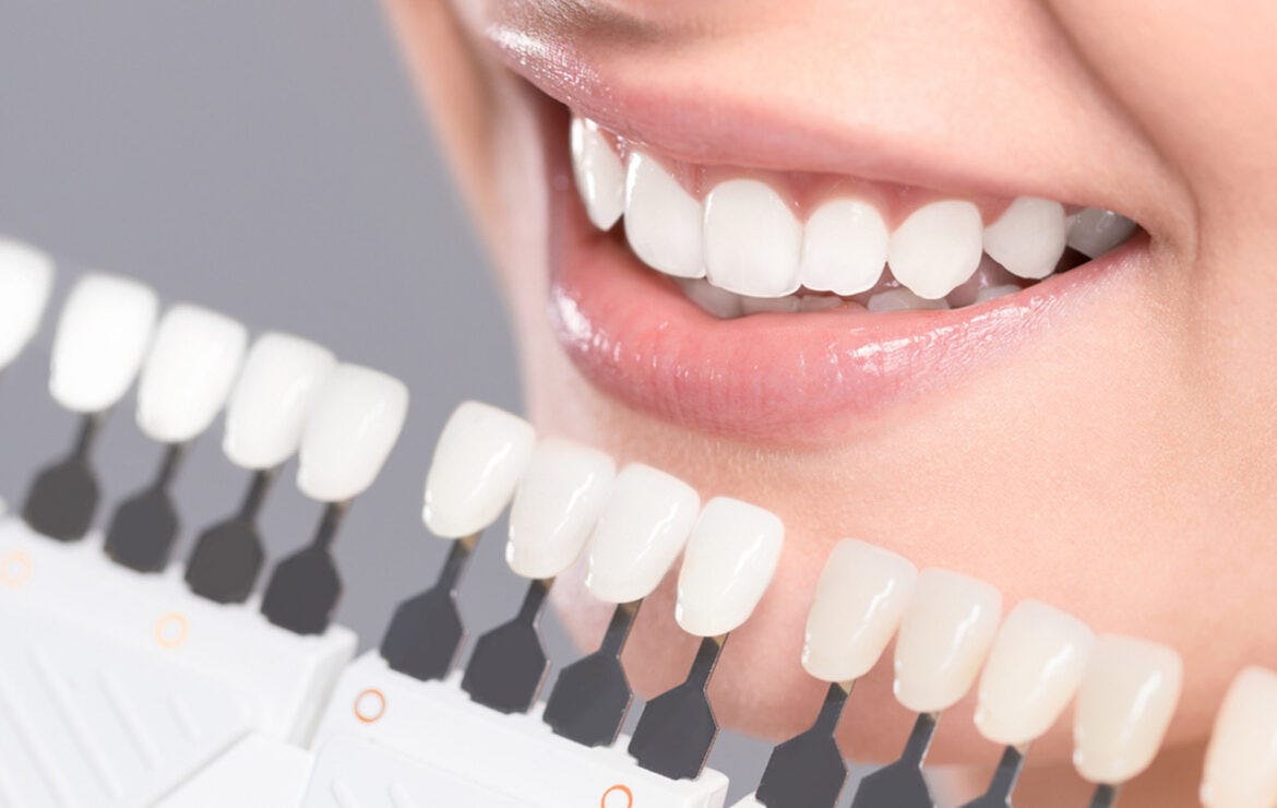 Why Should You Get Dental Veneers? | by North tampa Family Dental | Aug, 2024 | Medium