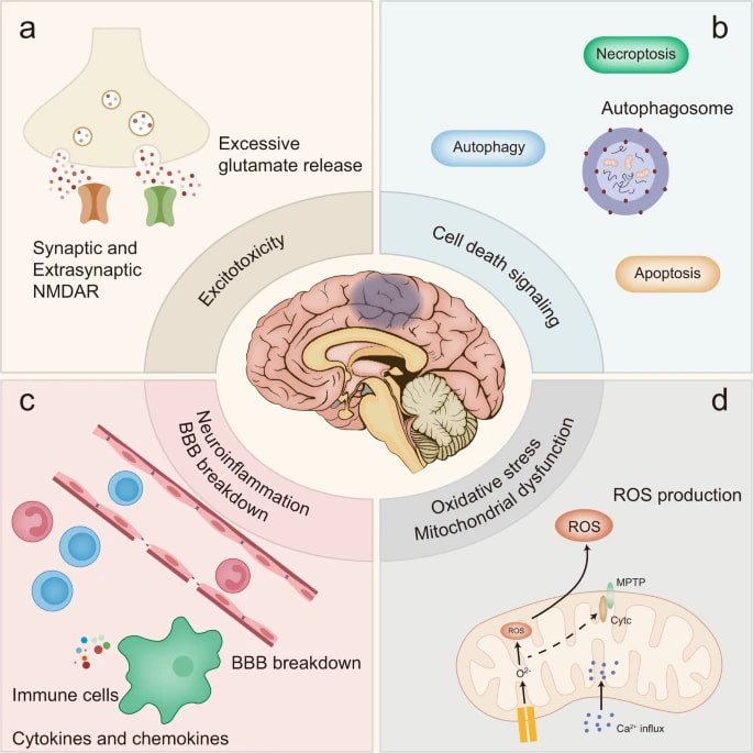 Pathogenic Mechanism Analysis Services for Stroke - Ace Therapeutics