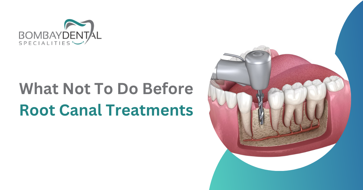 What Not To Do Before Root Canal Treatments | Bombay Dental Specialities