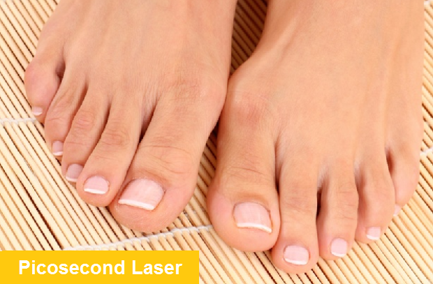 Say Goodbye To Toenail Fungus: Top Treatments For Beautiful Nails - Amongus