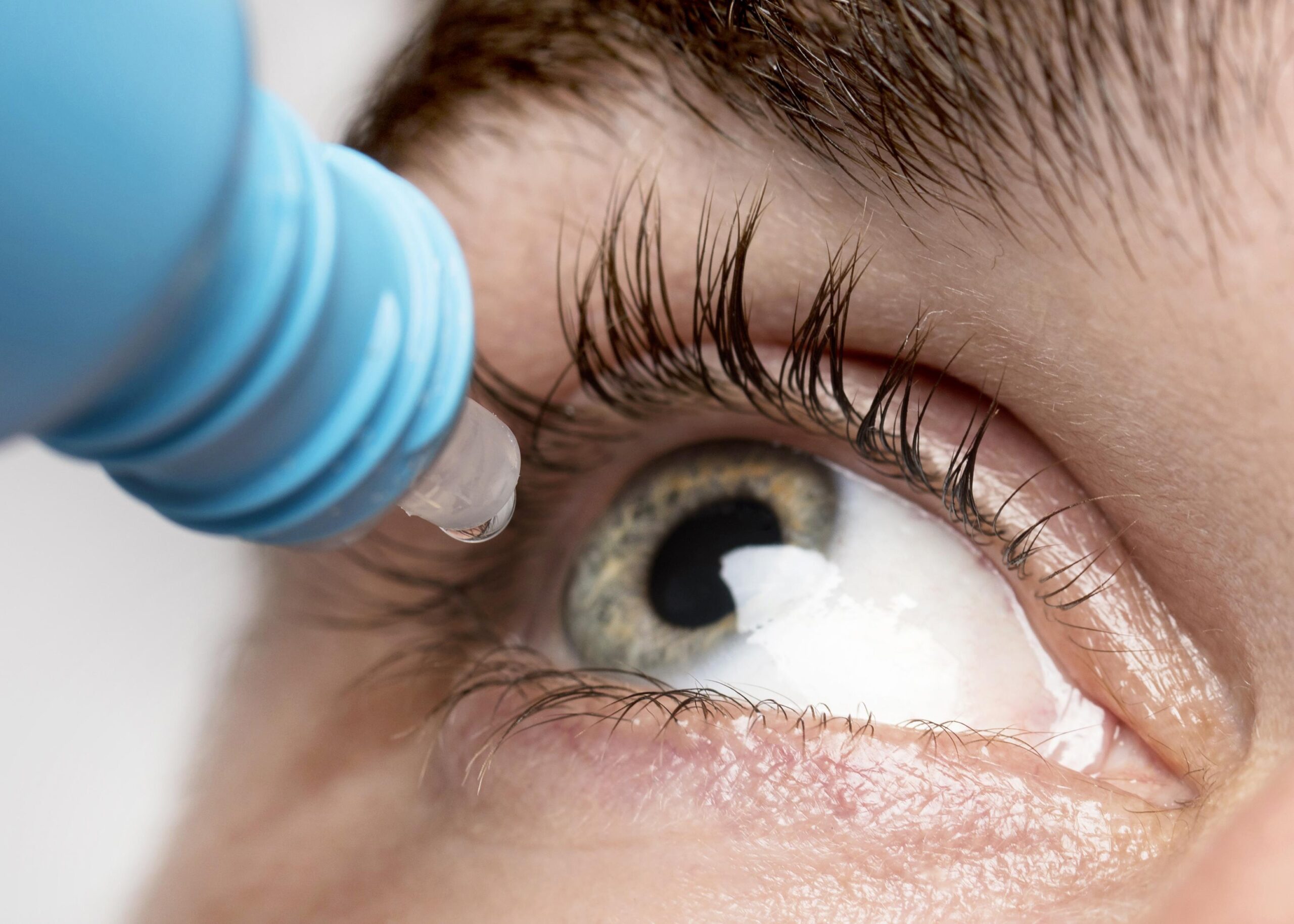 Advanced Keratoconus Treatment in Dubai by Dr. Rahul Raghav: