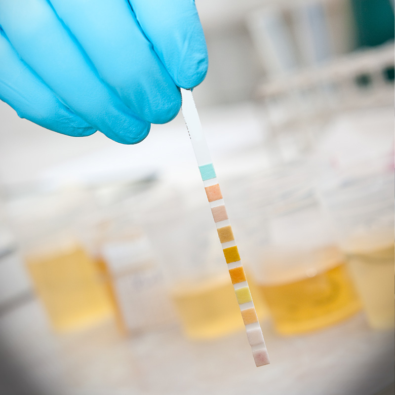 Reliable 5 Panel Urine Drug Test | POM Drug Testing Services