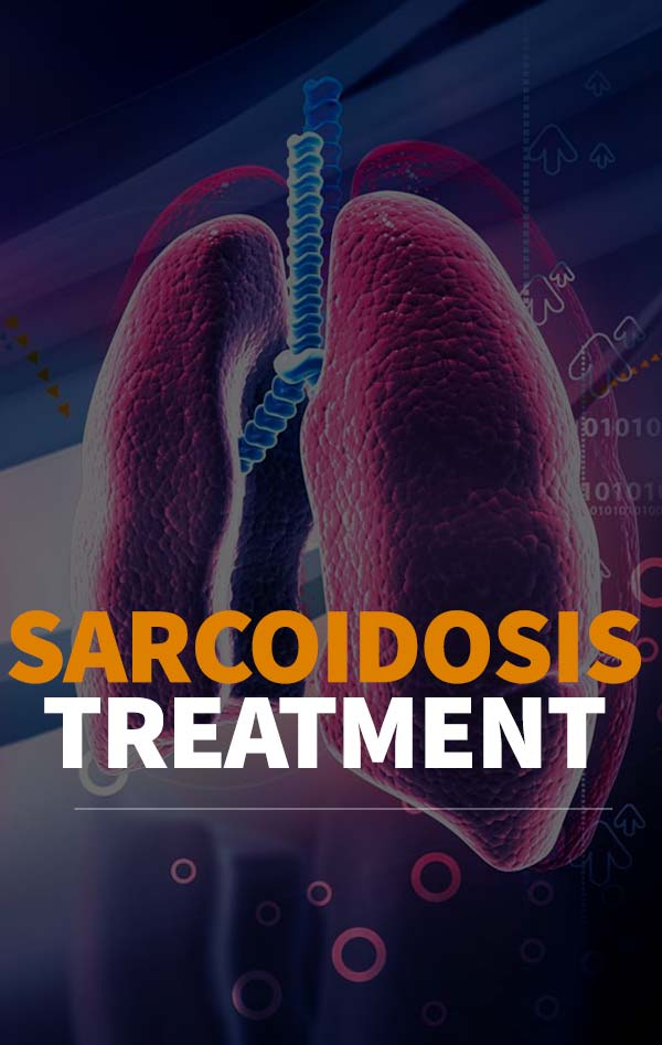 Sarcoidosis Of Lung Treatment, Sarcoidosis Lymph Nodes with Dr. Christian