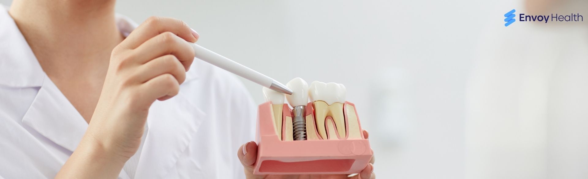 Dental implants in Algodones, Mexico| Save Big @ Top Dentists