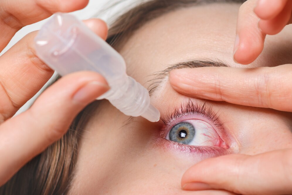 Expert Keratoconus Contact Lens Specialist: Dr. Rahul Raghav's Comprehensive Care in Dubai - ezine articles