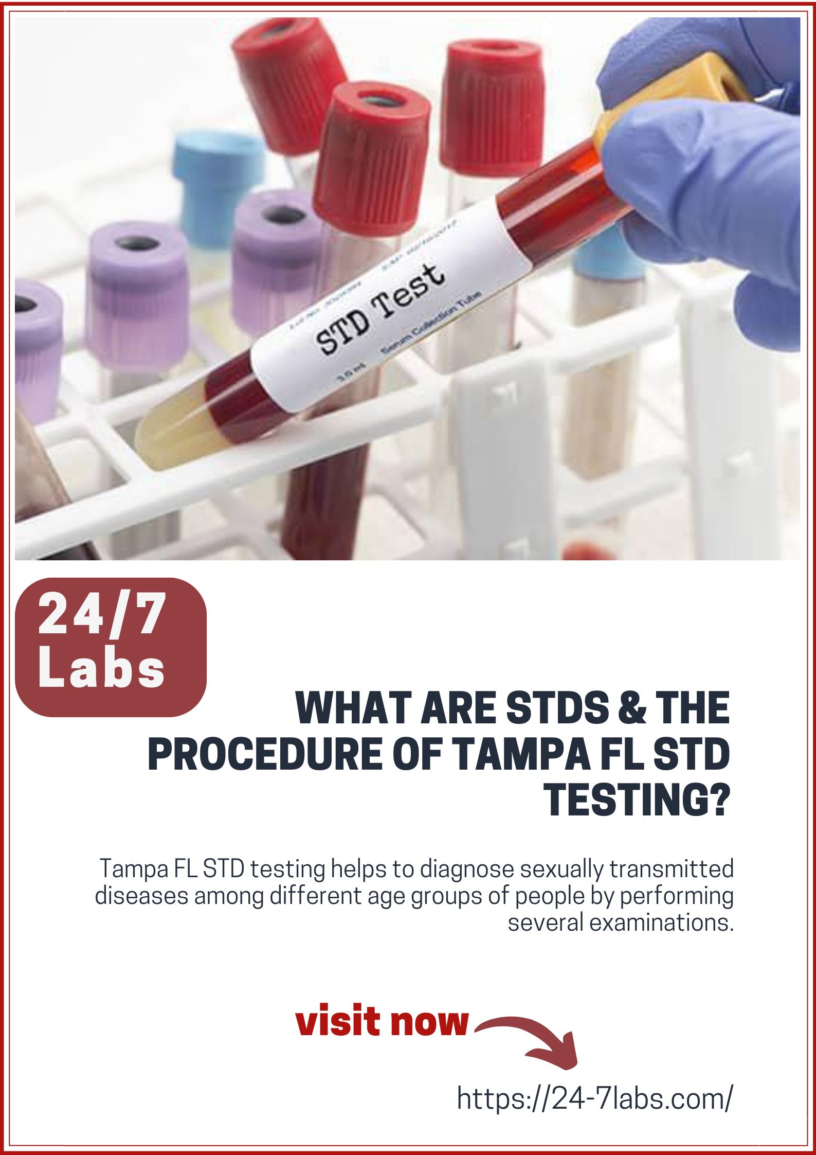 What are STDs & The Procedure of Tampa FL STD Testing? - MS Traveloo