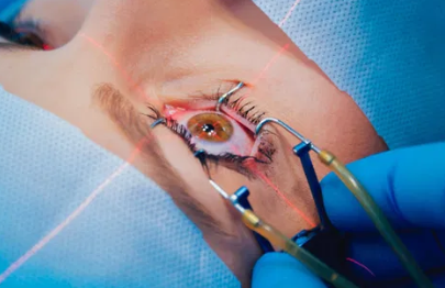 Understanding LASIK Eye Surgery Price UK: What To Expect - Click To Write