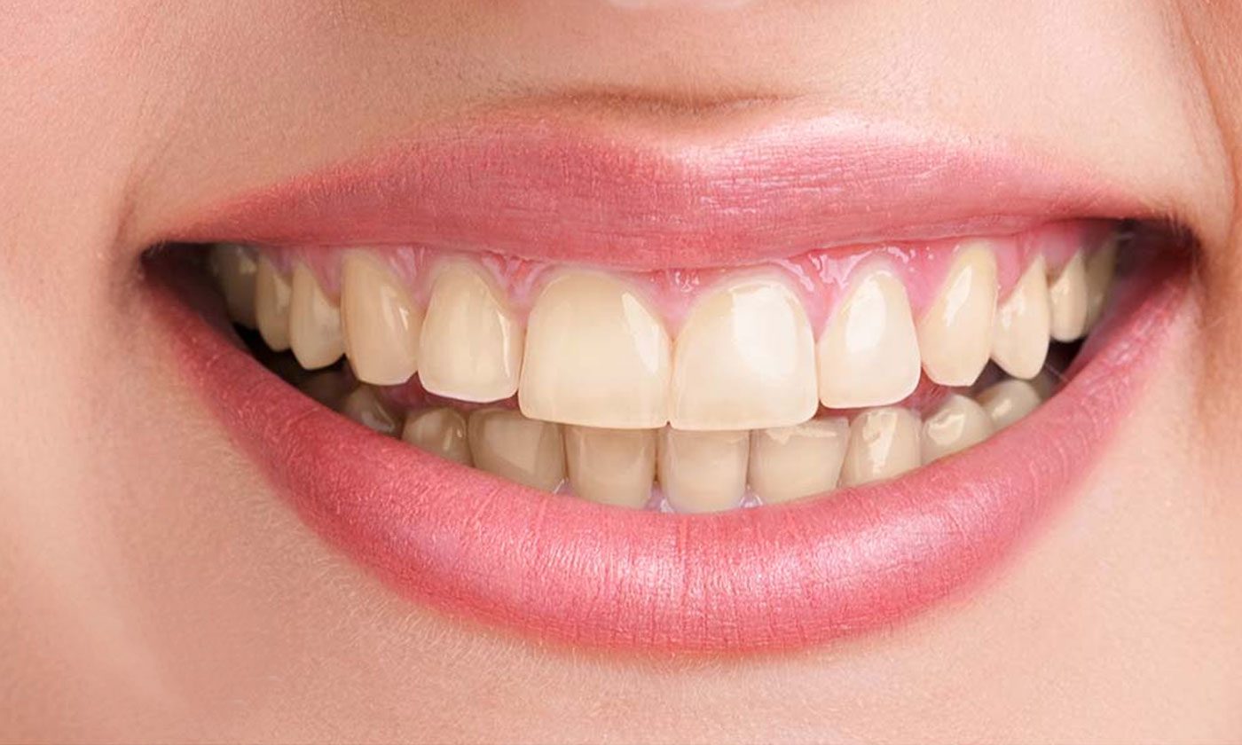 Best Cosmetic Dentist in Gurgaon | Teeth Whitening in Gurgaon - Alveo Dental