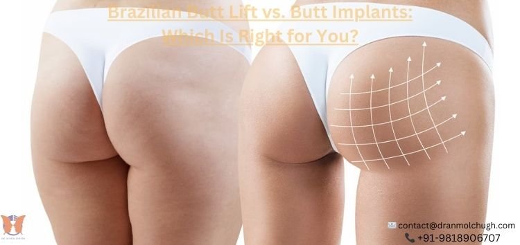 Ultimate Guide: Brazilian Butt Lift vs. Butt Implants – Which Is Right for You?