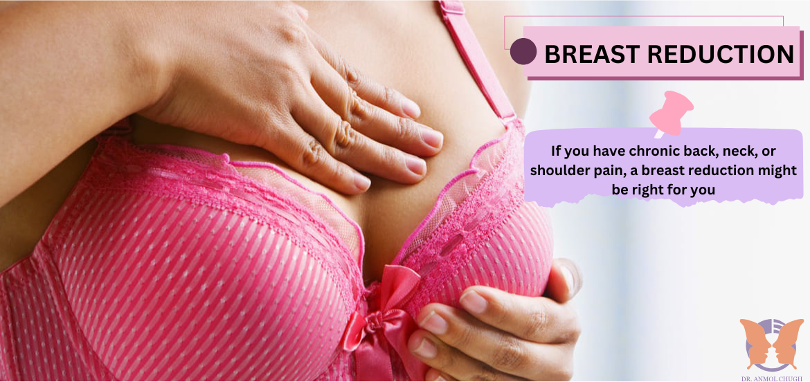 Breast Reduction Side Effects: What You Need to Know Before Surgery