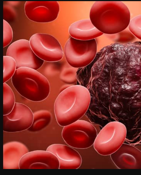 Understanding Blood Cancer Treatment in India  – Site Title