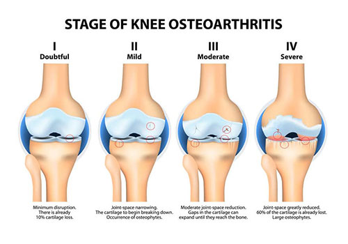 Best Knee Replacement Surgeon in Delhi | Dr. Saksham Mittal