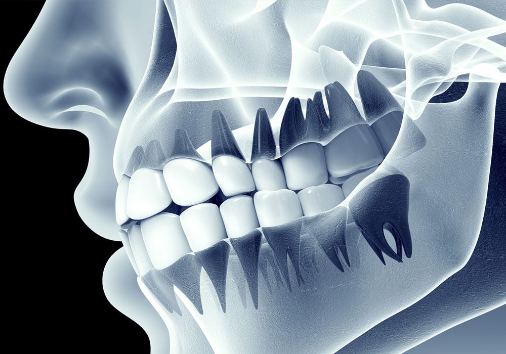 Dental X-Ray Centres in RR Nagar. Dental X-rays are a fundamental… | by Symphonysmiles | Feb, 2025 | Medium