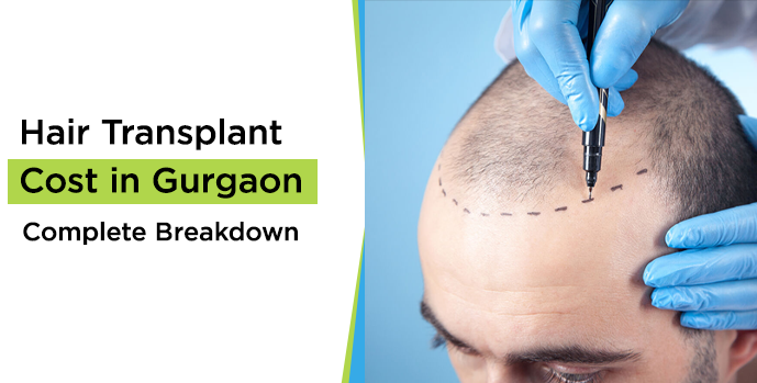 Hair Transplant Treatment: Is It Worth the Cost? | by Skinfinityderma | Feb, 2025 | Medium