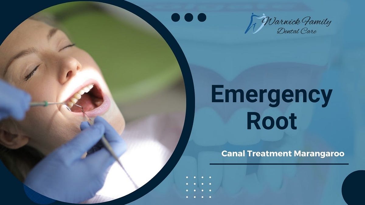 Emergency Root Canal Treatment Marangaroo | by Amelia | Mar, 2025 | Medium