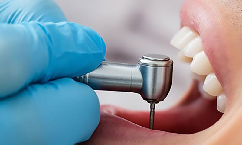 Restorative Dentistry Market Will Reach US$ 38.3 Billion