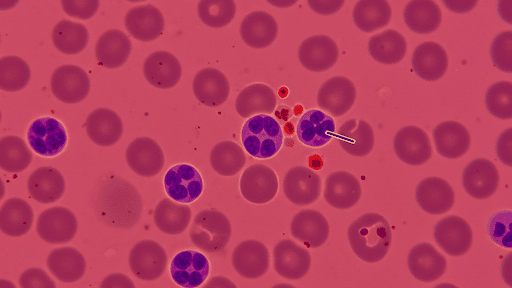 Shield Blood Test — A Simple Way to Spot Cancer Early - Takfe.com
