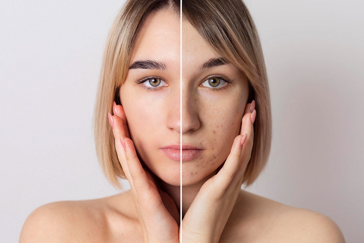 How to Prepare for Your First Laser Skin Session: A Complete Beginner’s Guide | by Skin Laser Centre | May, 2025 | Medium
