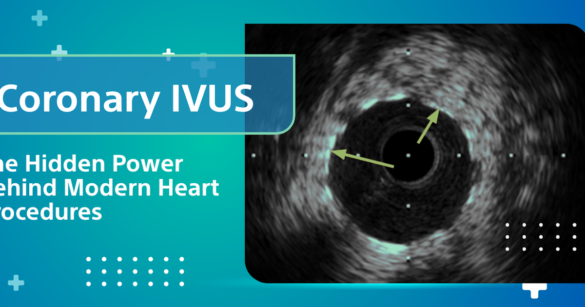 Coronary IVUS: Power Behind Angioplasty Success
