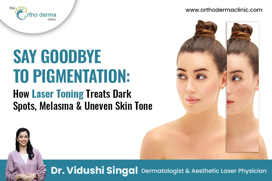 Laser Toning | Treat Melasma, Dark Spots & Uneven Skin