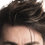 Regain Your Hair Without the Knife: A Non-Surgical Hair Replacement Guide - Tumblrblog