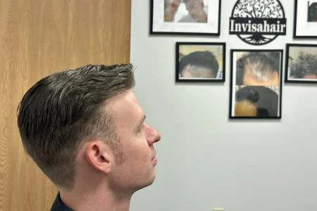 Common Misconceptions About Hair Loss -  WriteUpCafe